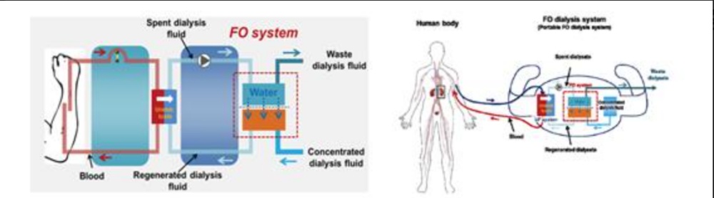 ▲ 전남대 신장질환연구센터, 김수완 교수팀 그래픽