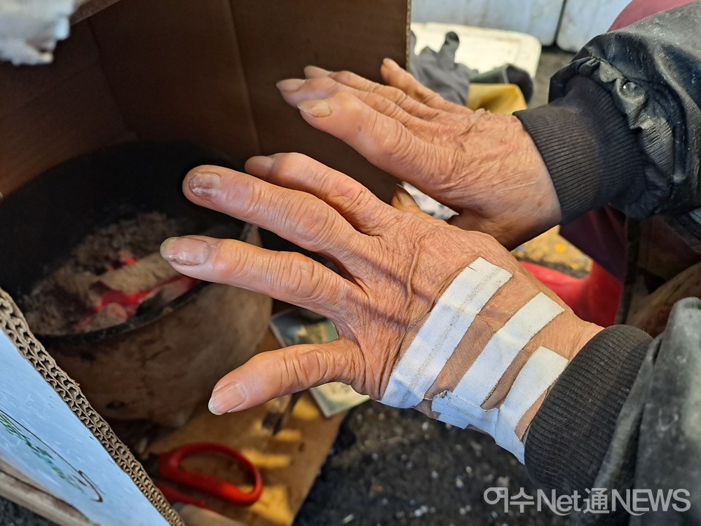 ▲ 삶에 지친 할머니의 손 마디마디는 구부러지고 손등에는 반창고를 덕지덕지 발랐다. ⓒ조찬현 (자료사진)