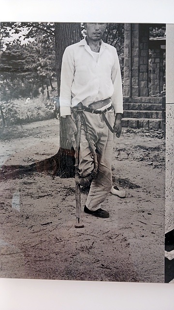 ▲제대로 된 치료시설과 병원이 없던 시절 다리를 절단한 한센병환자가 손수 만든 목발을 짚고 서있는 모습 ⓒ 애양병원 박물관 제공